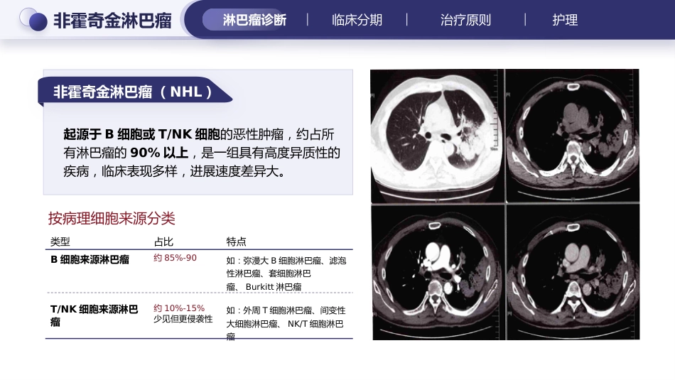 淋巴瘤的治疗与护理_第14页