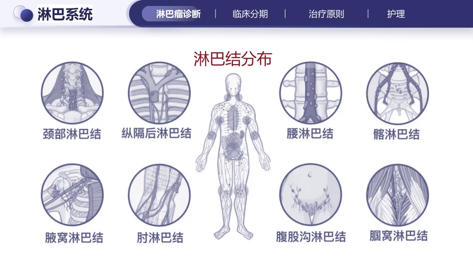 淋巴瘤的治疗与护理_第6页