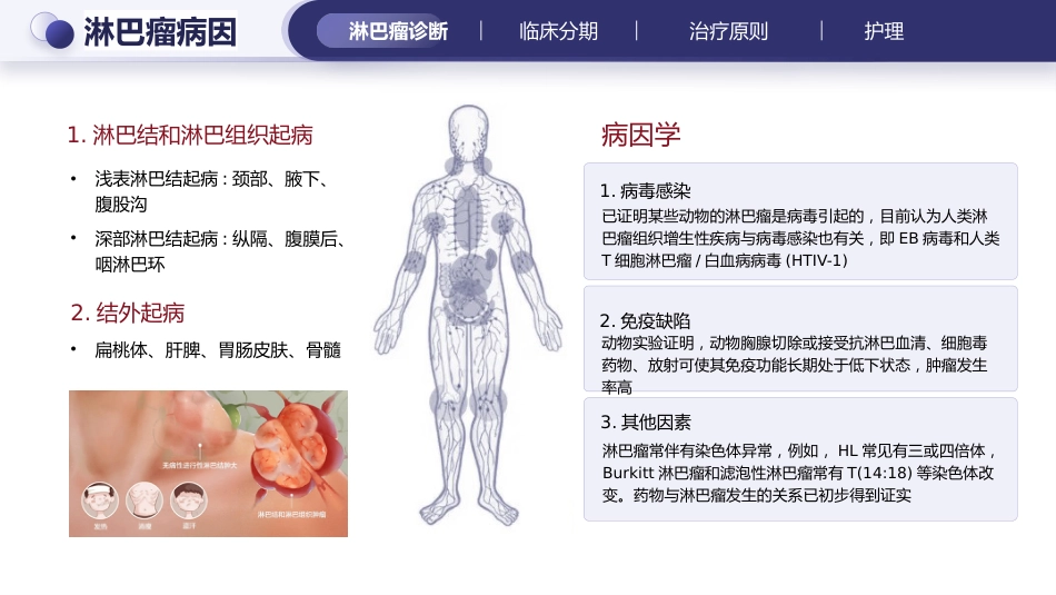 淋巴瘤的治疗与护理_第8页