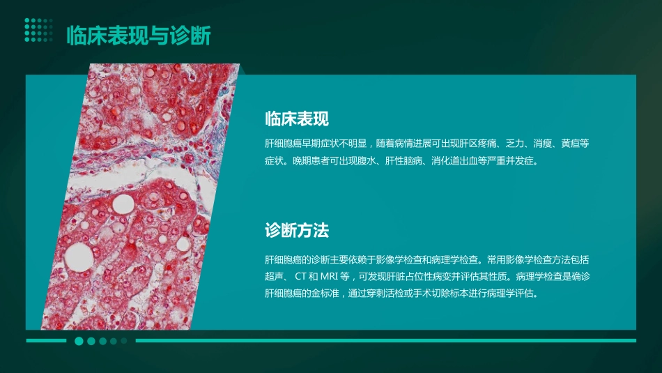 中国肝细胞癌经动脉化疗栓塞(TACE)治疗临床实践指南解读PPT课件_第10页