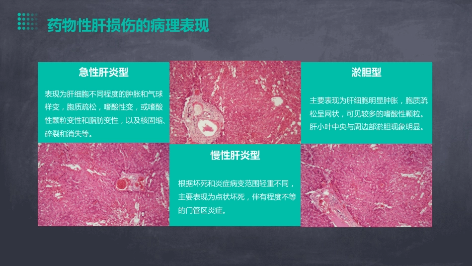 中国药物性肝损伤诊治指南(版)解读PPT课件_第12页