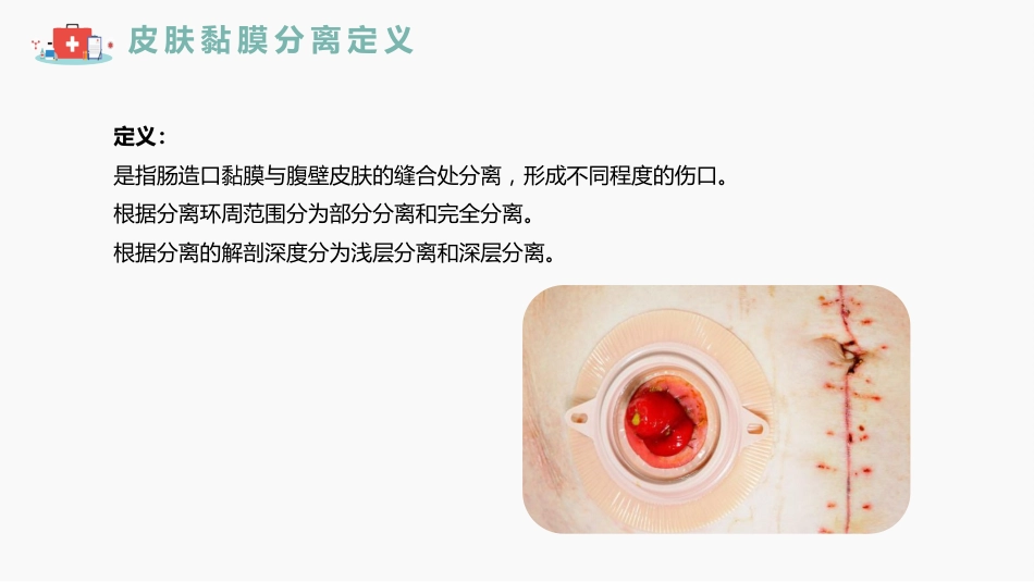 成人肠造口皮肤黏膜分离护理指南解读_第3页