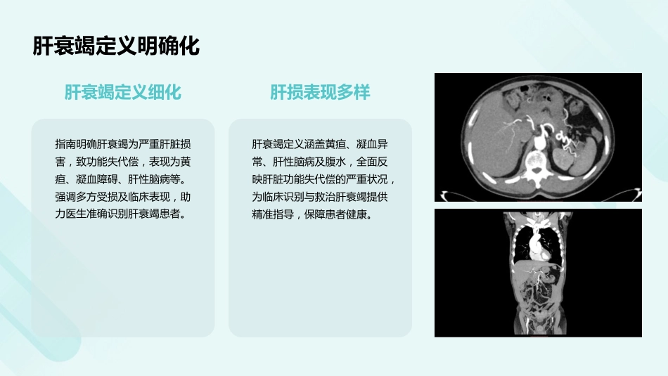 《肝衰竭诊治指南(2024年版)》解读PPT课件_第8页