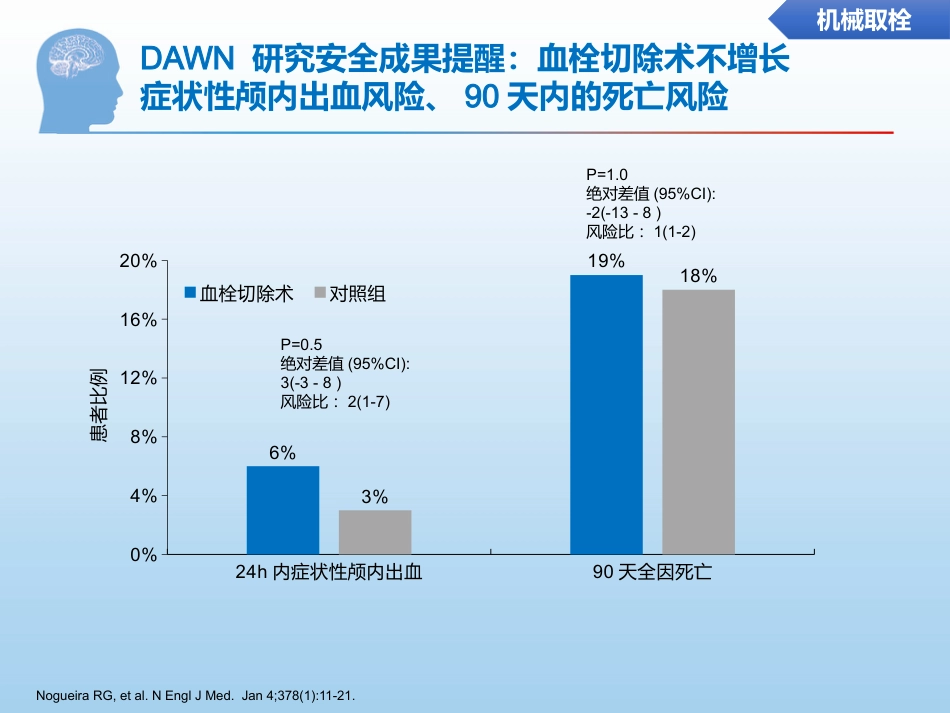 中国缺血性脑卒中诊治指南更新要点解读_第14页