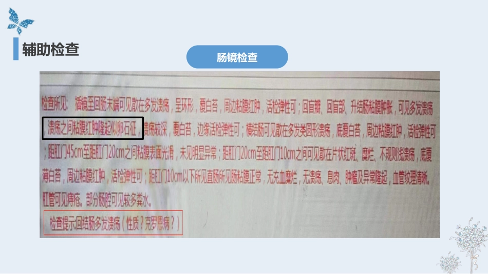 克罗恩病的护理查房_第15页