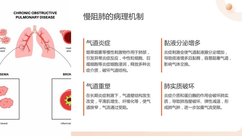 慢阻肺护理查房_第7页