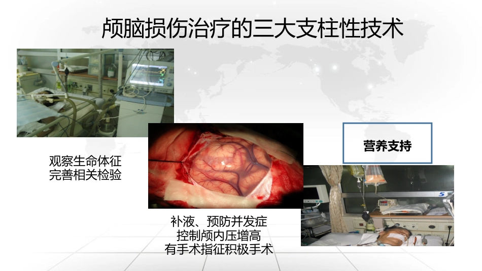 重症脑损伤患者的营养治疗_第7页