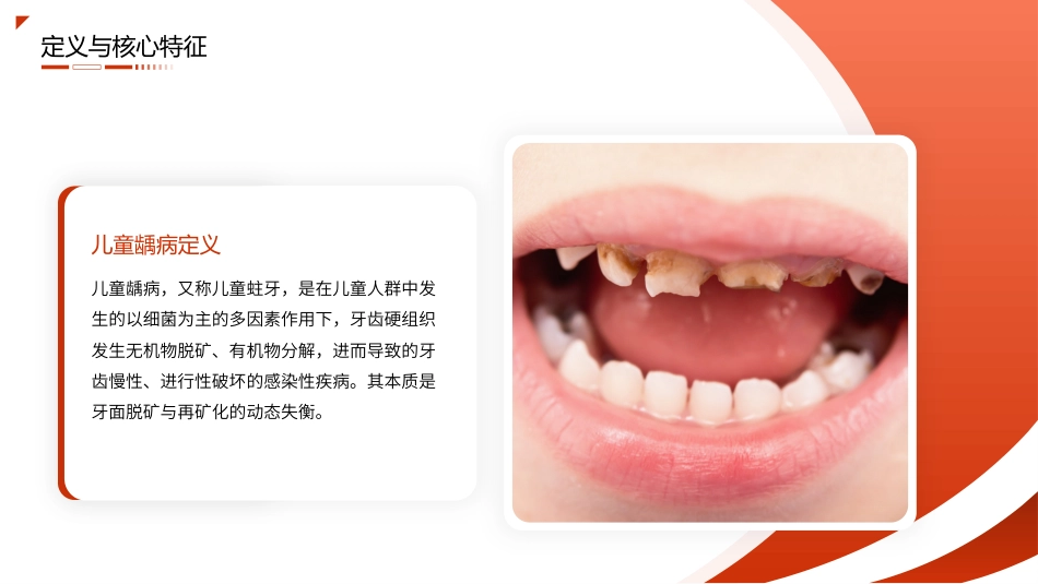 儿童龋病护理查房带参考文献_第4页