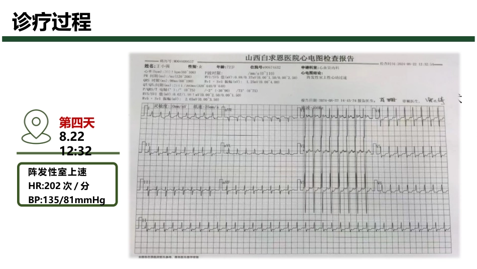 1例快速性心律失常患者的护理查房_第12页