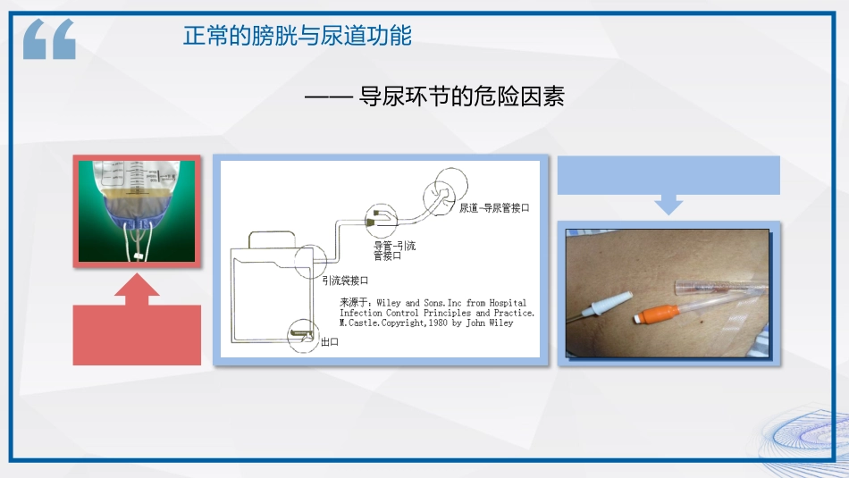 间歇性导尿技术_第12页