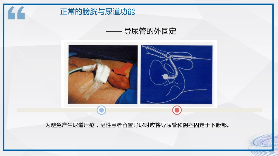 间歇性导尿技术_第13页