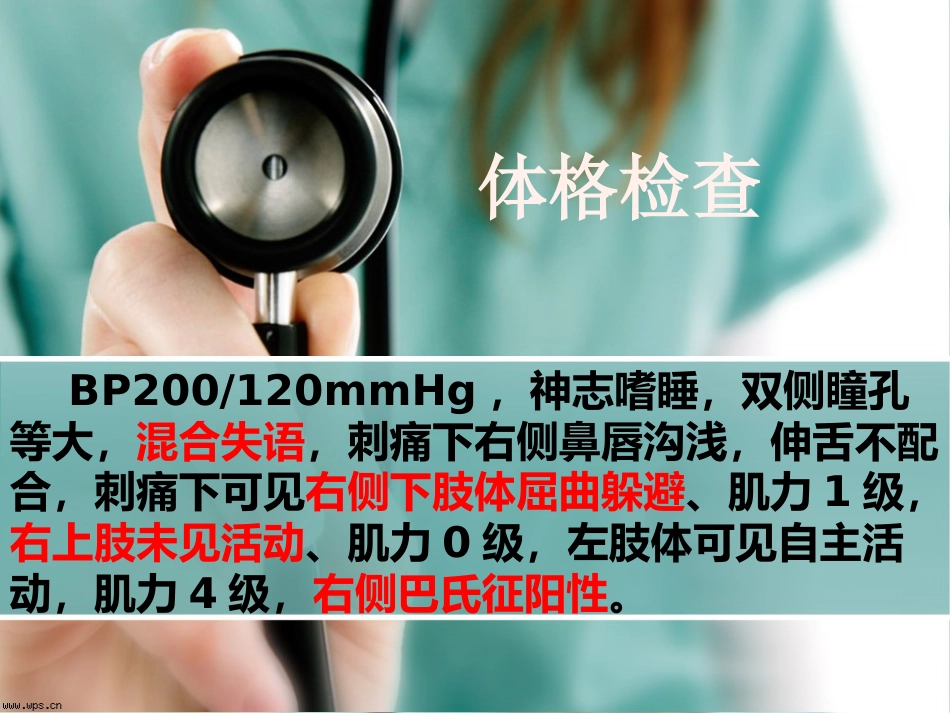 脑梗死护理查房_第11页