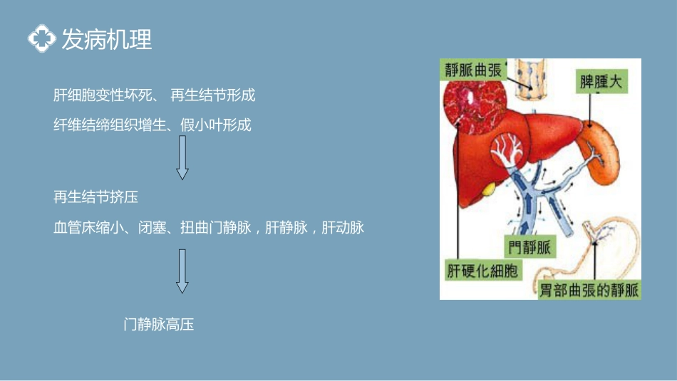 内科护理：肝硬化腹水病人的护理PPT模板_第6页