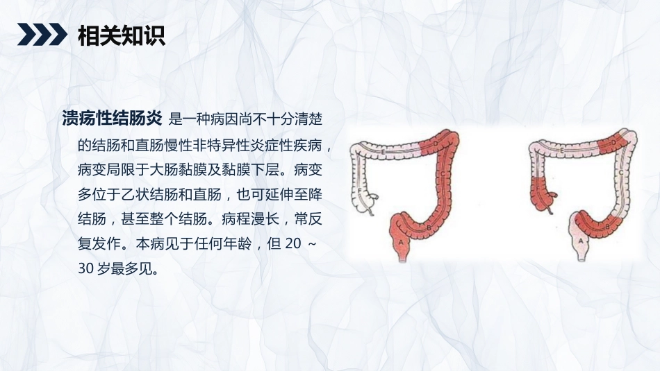 内科护理：溃疡性结肠炎护理查房_第4页