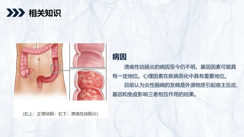 内科护理：溃疡性结肠炎护理查房_第5页