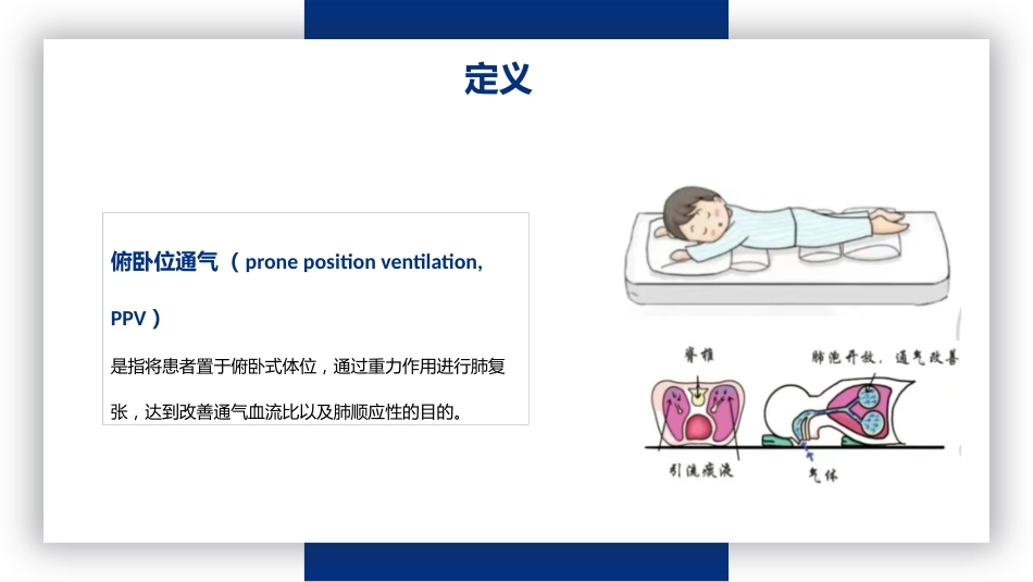 俯卧位通气_第4页