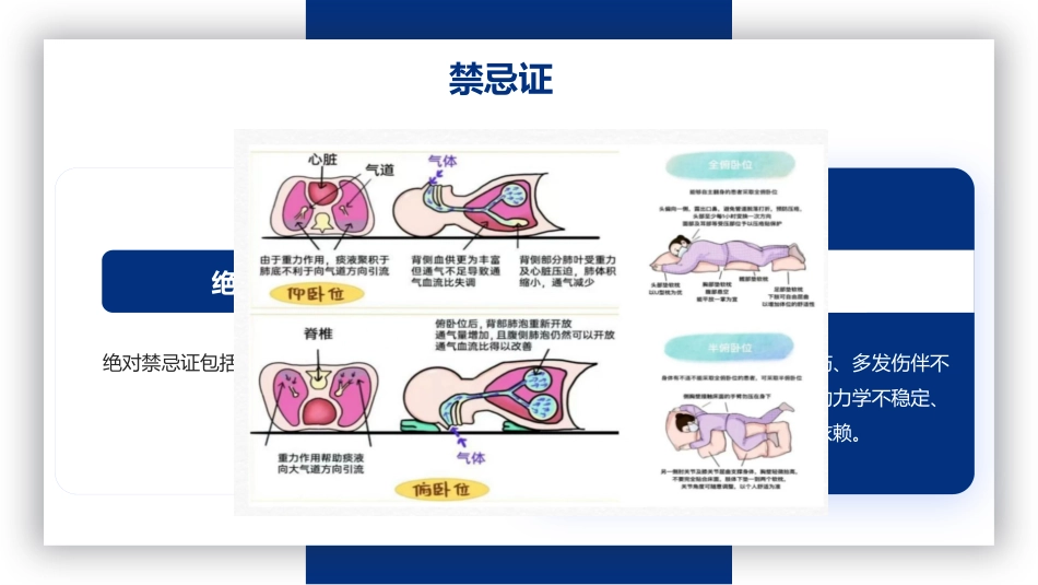 俯卧位通气_第6页