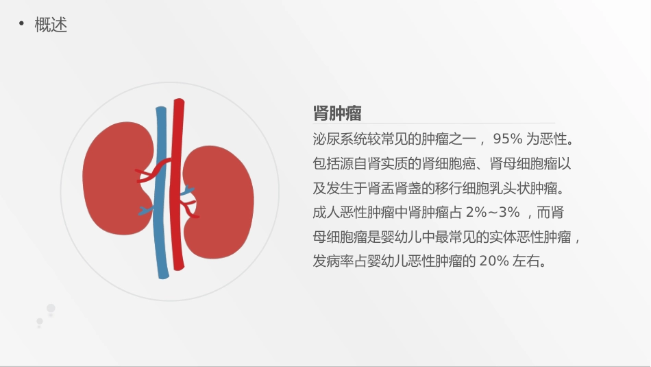 内科护理：肾肿瘤护理查房综合新课件_第4页