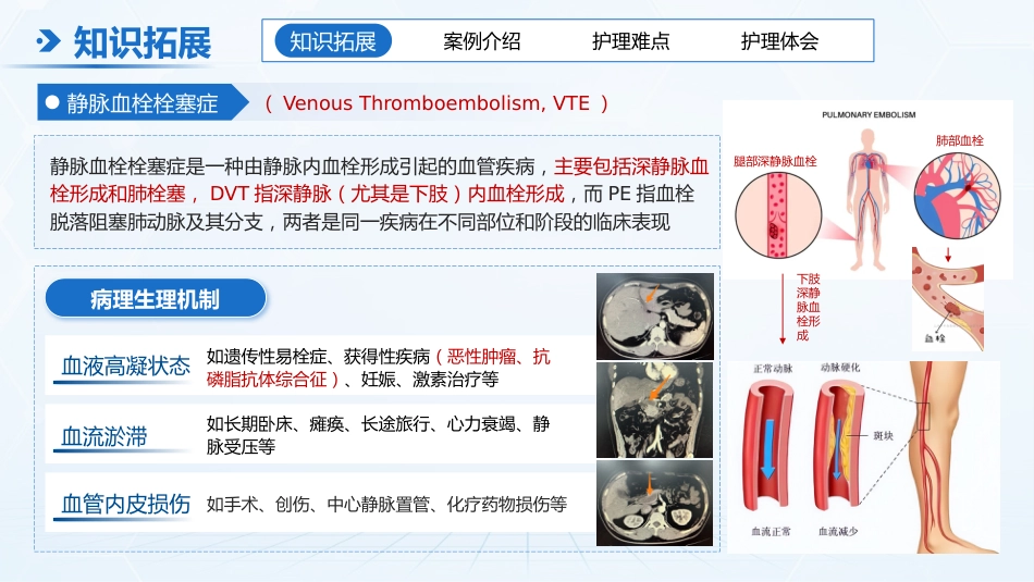 护理疑难病例讨论模板_第3页