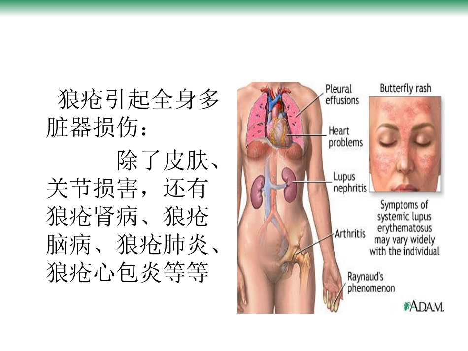 尿毒症的常见病因_第6页
