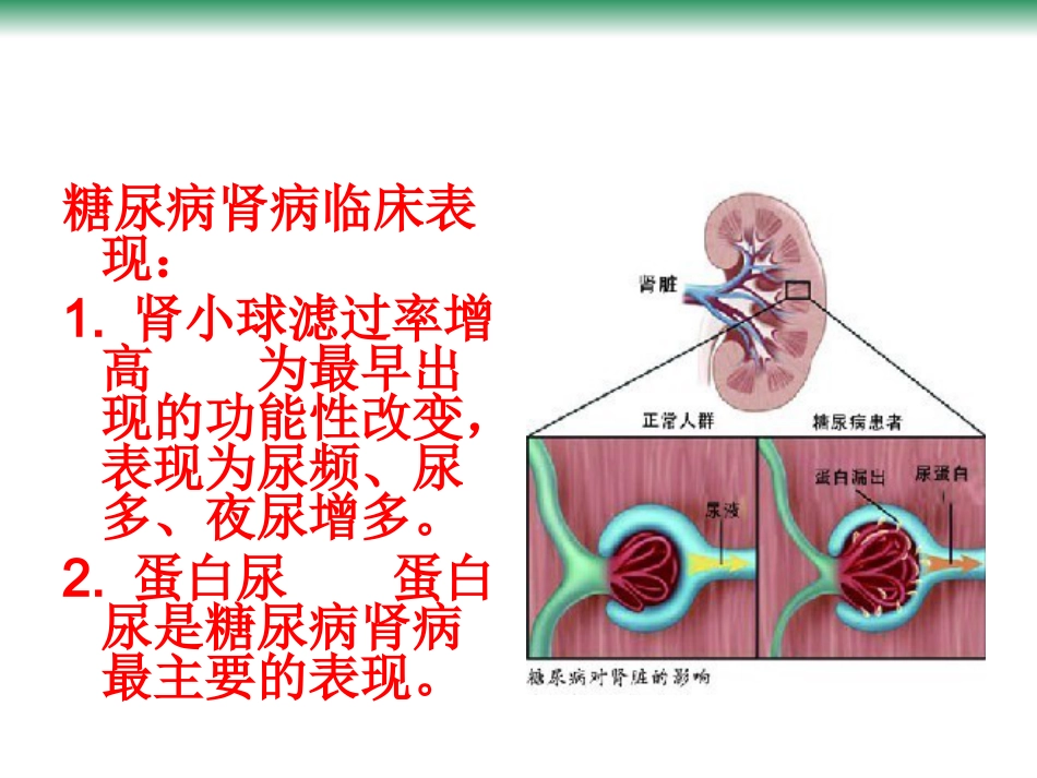 尿毒症的常见病因_第8页