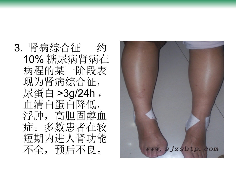 尿毒症的常见病因_第9页