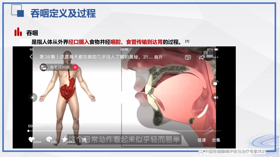 脑卒中吞咽障碍患者的评估与护理_第7页