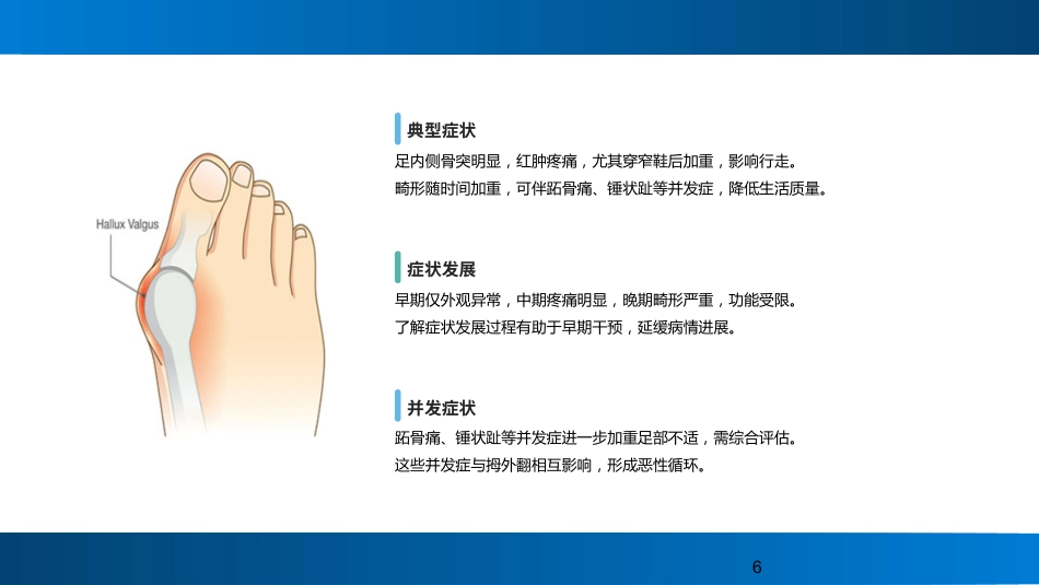 拇外翻（Hallux+Valgus）的概念及分型_第6页