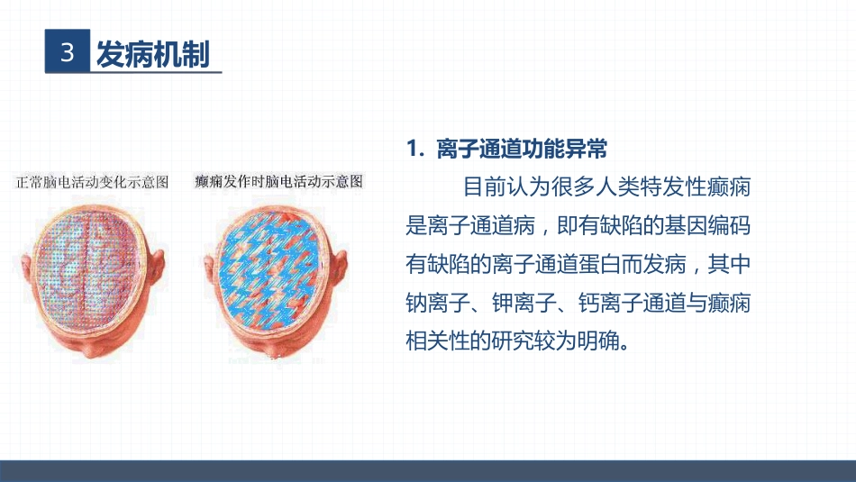 症状性癫痫患者的护理查房_第10页