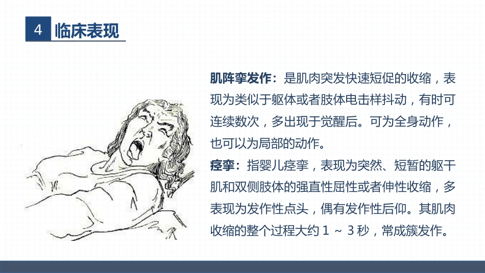 症状性癫痫患者的护理查房_第15页