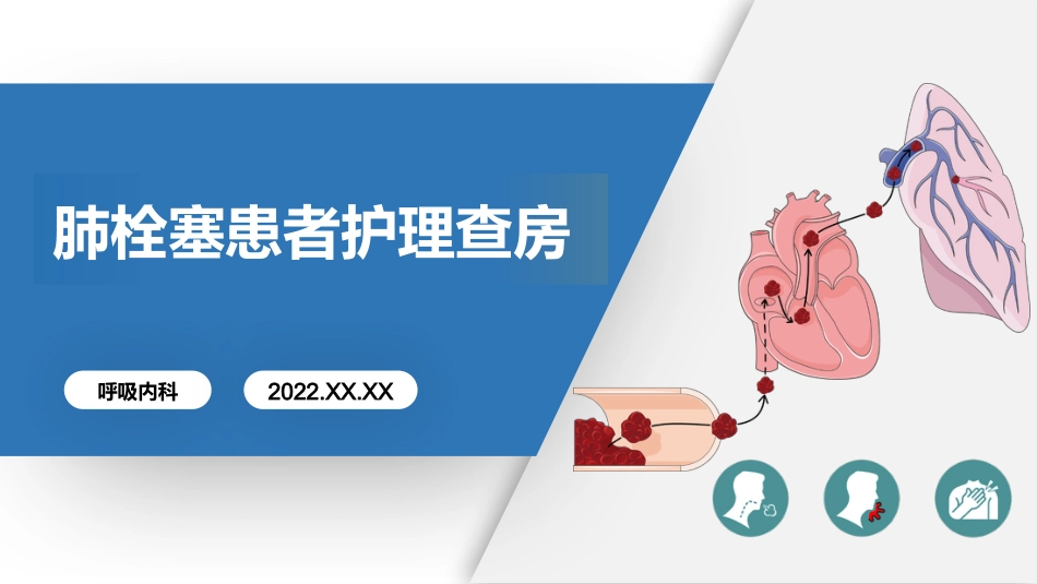 肺栓塞患者护理查房_第1页