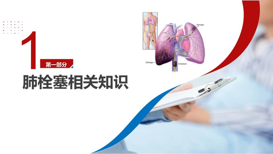 肺栓塞患者护理查房_第4页