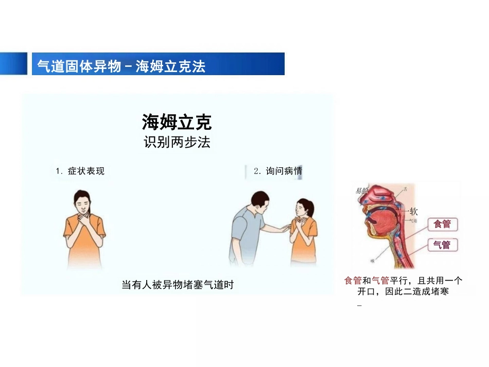 患者发生误吸的应急处理_第13页