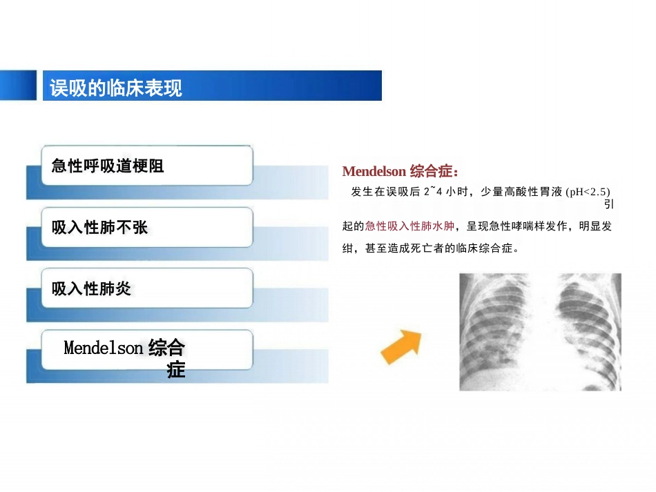 患者发生误吸的应急处理_第6页