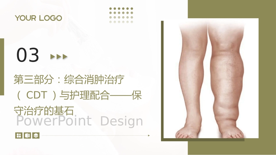 下肢淋巴水肿护理查房带参考文献_第10页