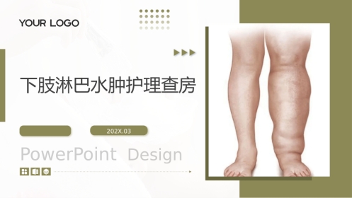 下肢淋巴水肿护理查房带参考文献