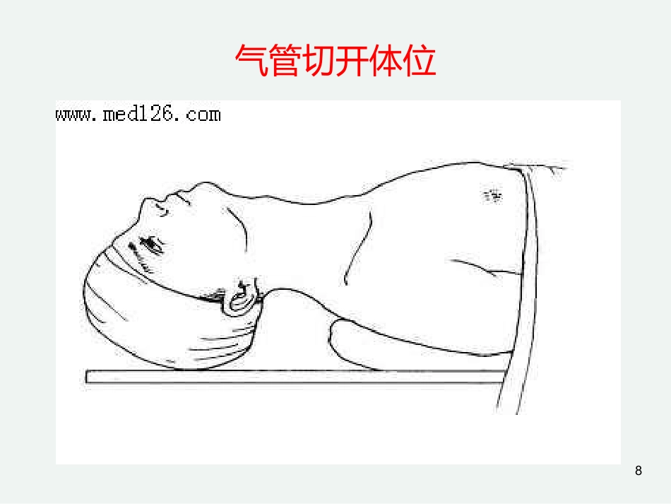 气管切开后的护理常规_第8页