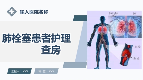 肺栓塞患者护理查房ppt课件