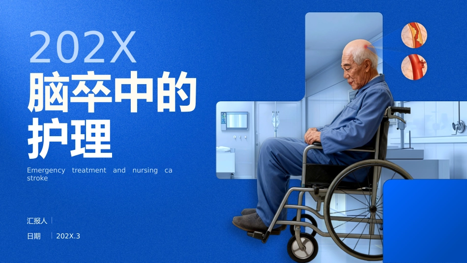 脑卒中的护理_第1页