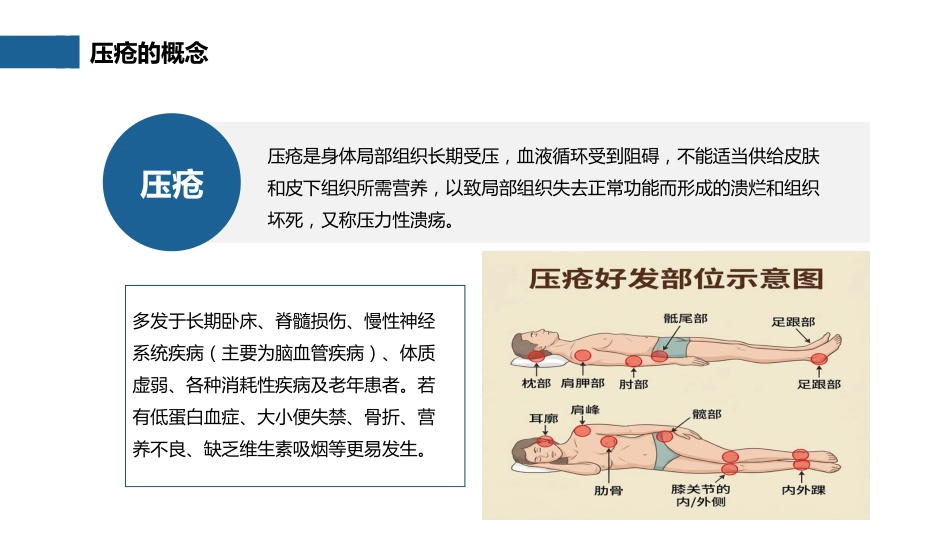 压疮预防及护理_第4页