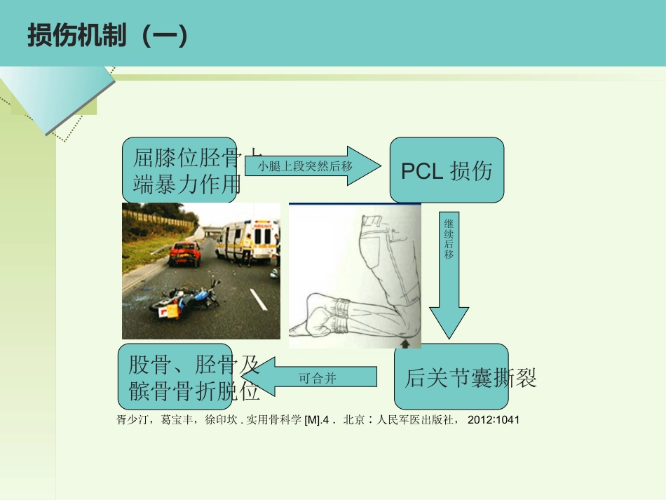 后交叉韧带重建术的护理_第10页