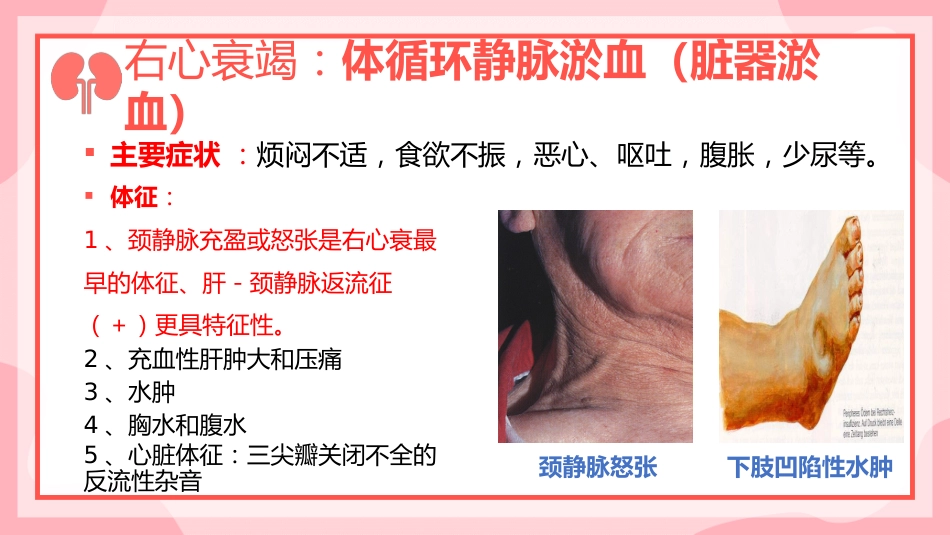 慢性心功能不全护理查房_第11页
