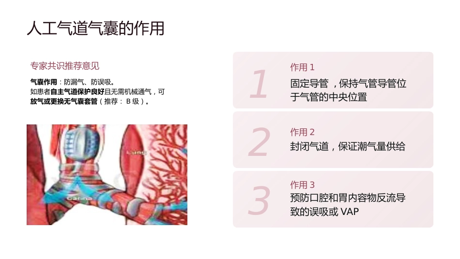 人工气道气囊的管理_第12页