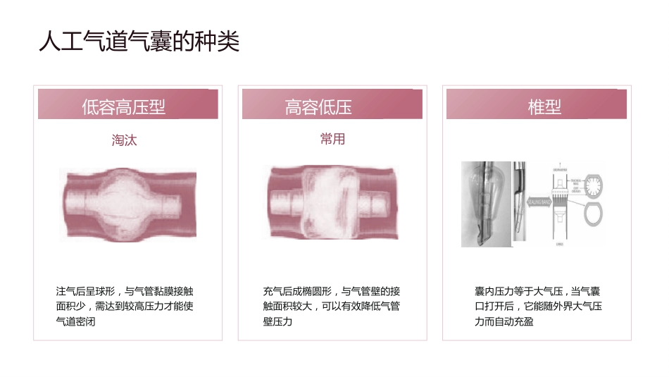 人工气道气囊的管理_第13页