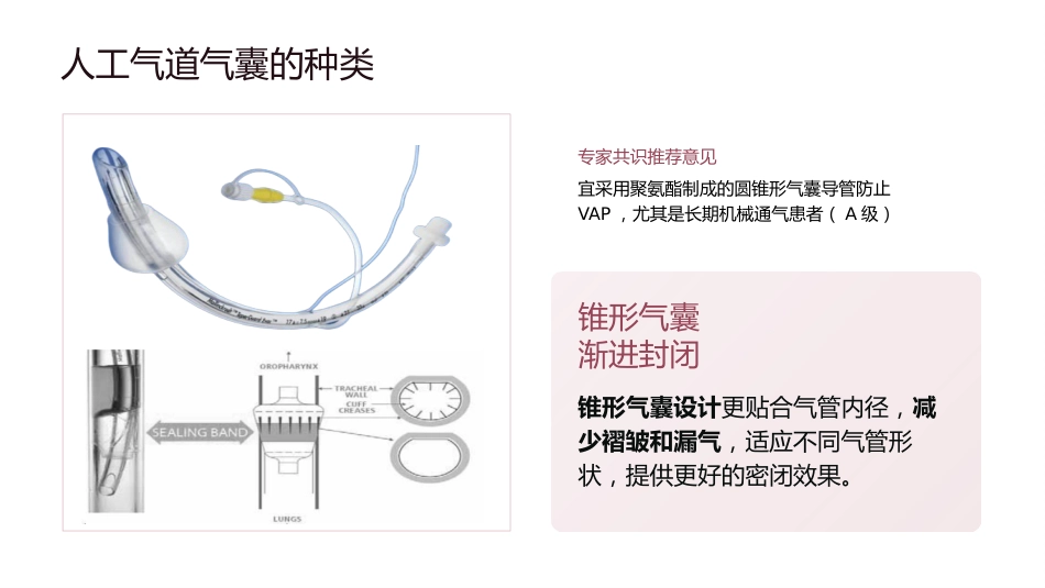 人工气道气囊的管理_第14页