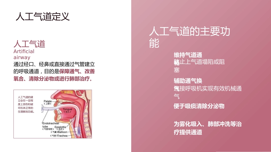 人工气道气囊的管理_第4页