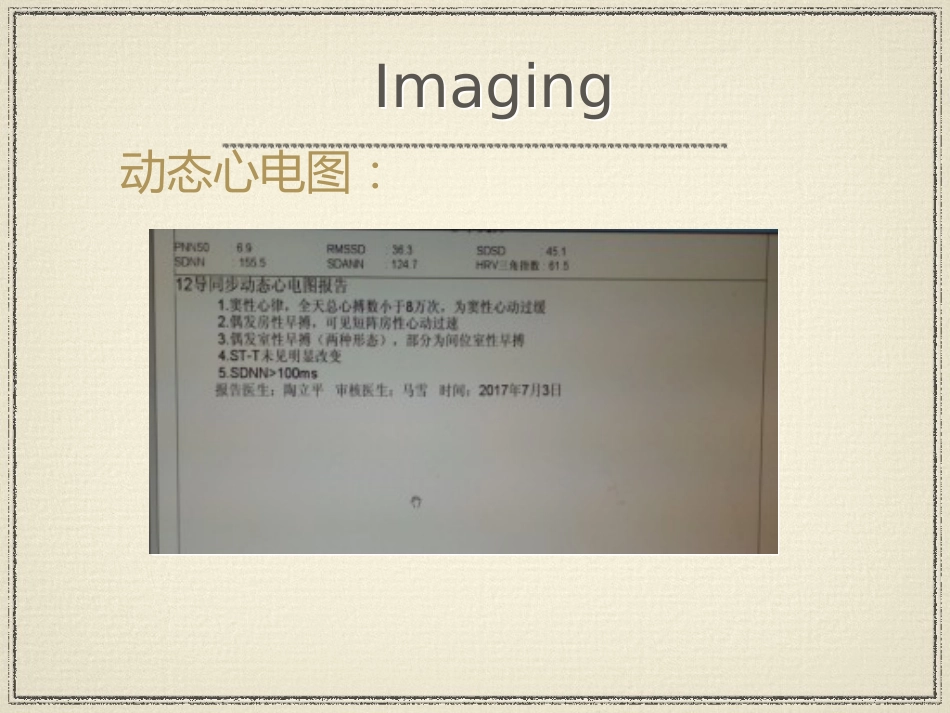 教学查房脑梗塞ppt_第11页