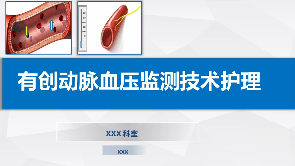 有创动脉血压监测技术护理_第1页