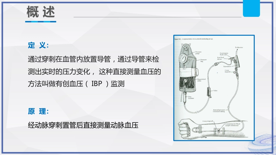 有创动脉血压监测技术护理_第6页