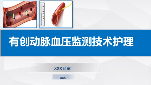 有创动脉血压监测技术护理